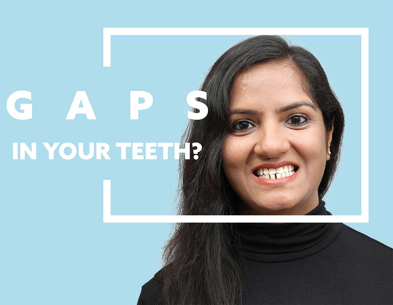 Gaps In Teeth